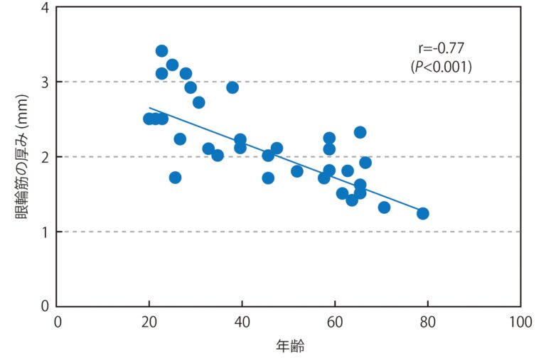 眼輪筋の厚みは20代より2/3も薄くなる！