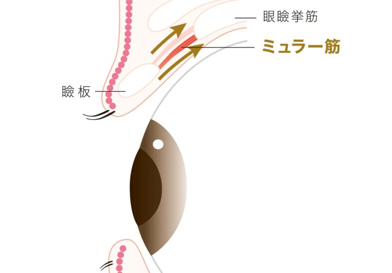 平滑筋（ミュラー筋）