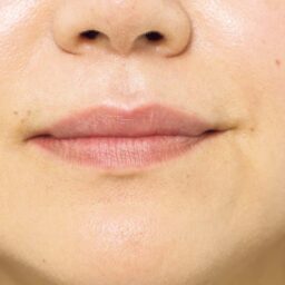 素の唇は赤みが少なく不健康