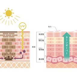 ターンオーバーが乱れるとトラブルのもとに