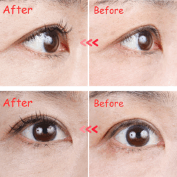 ケサランパサラン　アイラッシュデザイニング　before→after