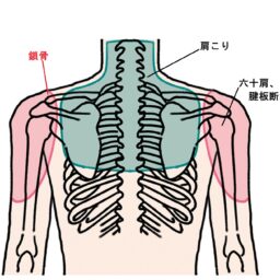 ３つの不調の痛みが出る場所の違い