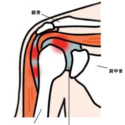 六十肩とは