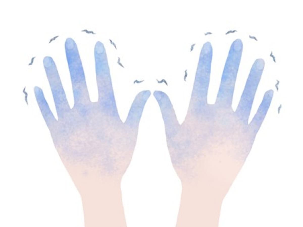 指のこわばりの原因