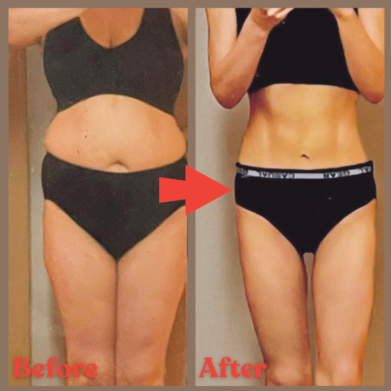 前田式正面Before→After