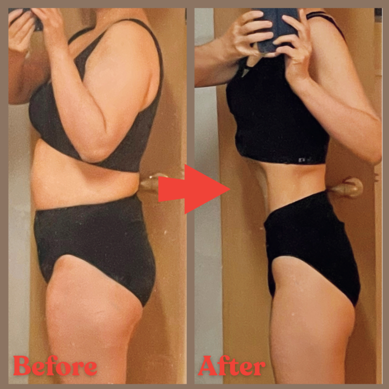 前田式側面Before→After