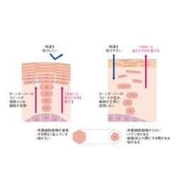 ターンオーバーの乱れによって肌内部に起きること