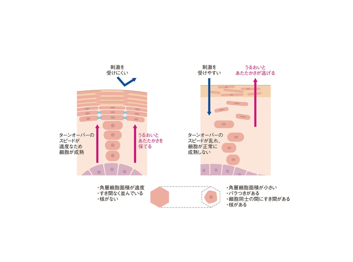ターンオーバーの乱れによって肌内部に起きること