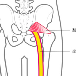 坐骨神経痛とは？