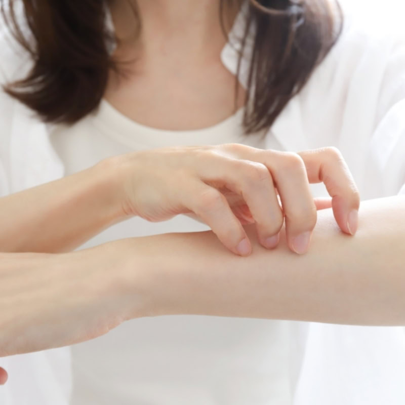 【60代ヘルスケア】突然あらわれる湿疹の理由と今日からできるケア【薬剤師監修】