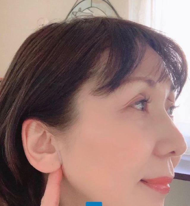 さとう式リンパケアの「ゆるめるケア」