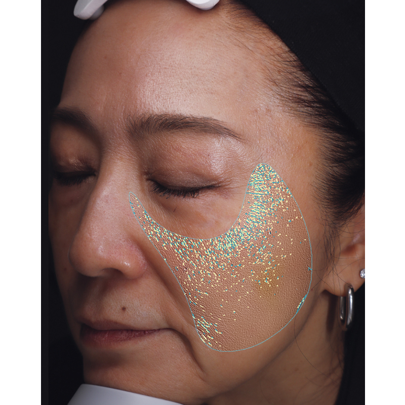 【VISIA肌診断を読者が体験】肌の赤みと乾燥の原因が明らかに!シワやたるみの加速に要注意