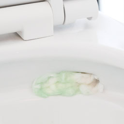汚れた部分に丸めたトイレットペーパーを貼り、ゴム手袋をつけてトイレ用酸性洗剤をかけ、2～3分置く。ペーパーを外し、トイレブラシで汚れをこすり落とし、水を流す。