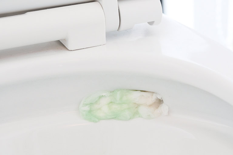 汚れた部分に丸めたトイレットペーパーを貼り、ゴム手袋をつけてトイレ用酸性洗剤をかけ、2～3分置く。ペーパーを外し、トイレブラシで汚れをこすり落とし、水を流す。